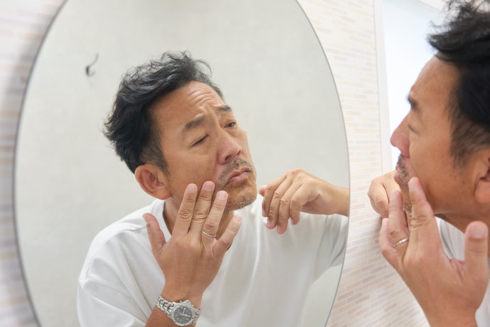 シワ改善・美白ケアには、ナイアシンアミド配合の医薬部外品がおすすめ