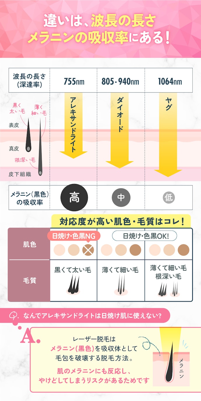 レーザーは主に3種類!それぞれ対応している「肌色・毛質」が異なる