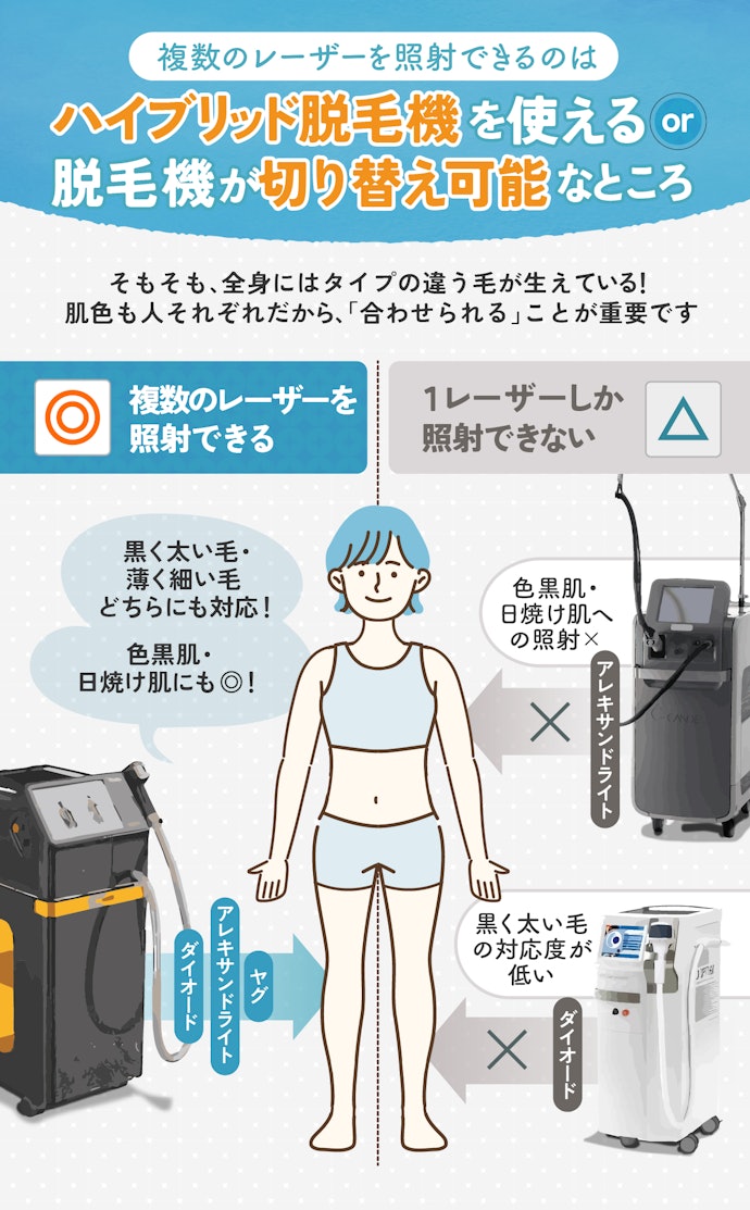 レーザーは3種類。全身の幅広い毛質に対応するために、複数のレーザーを照射できるところを選んで!