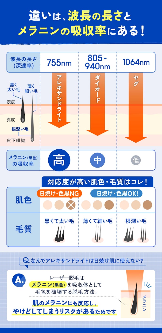レーザーは3種類!それぞれ対応している「肌色・毛質」が異なります