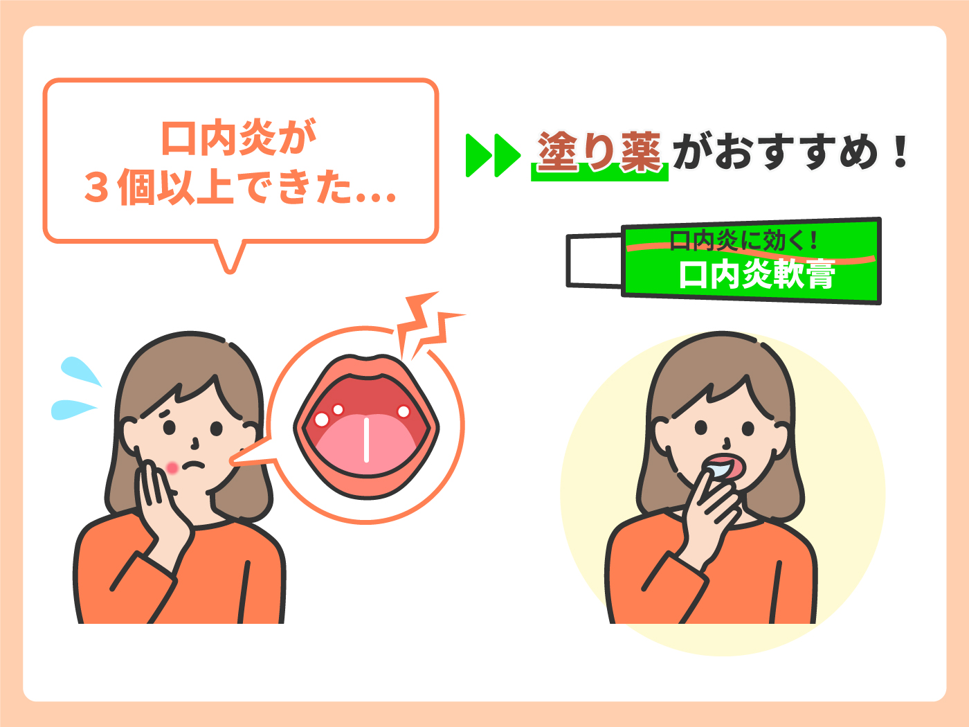 口内炎に効く薬のおすすめ人気ランキング【2026年7月】 | マイベスト