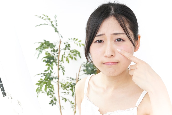 「ピコレーザー」は幅広い種類のシミに対応。ダウンタイムが短いのもポイント