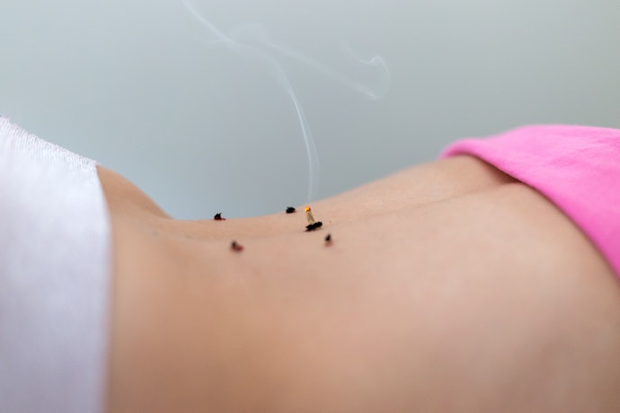 「もぐさ」を使った点灸は、上級者や指導を受けてから