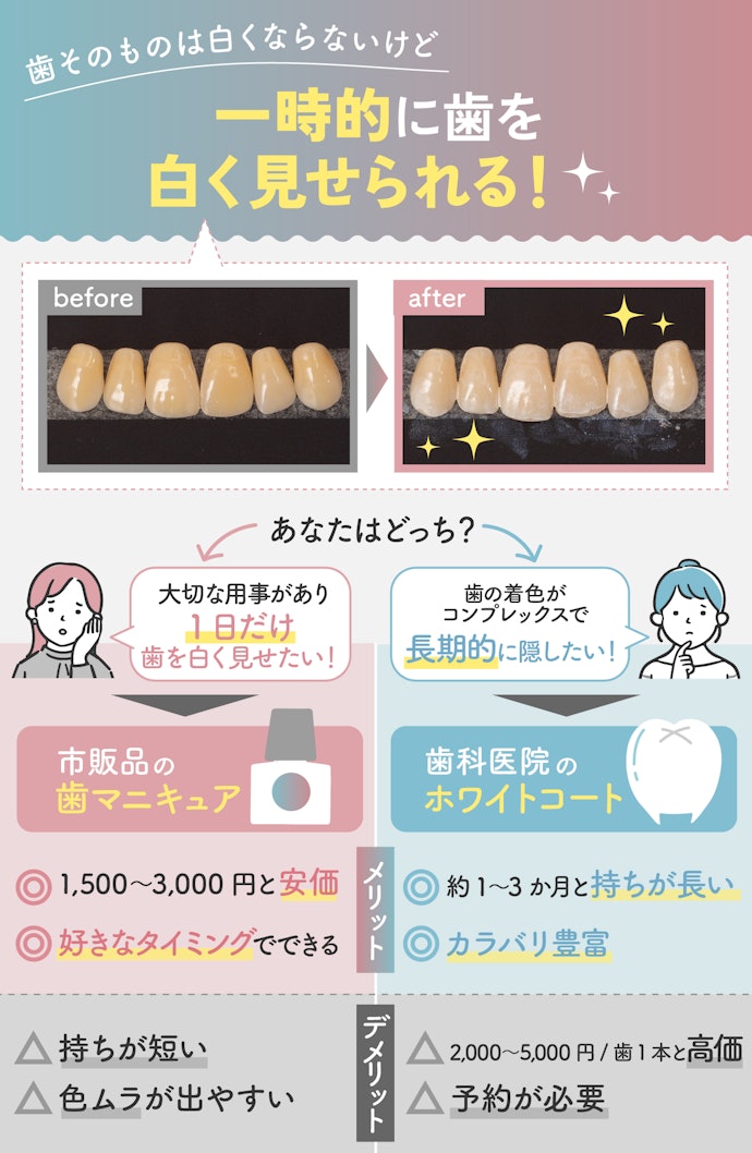 特別な日に歯の色をトーンアップさせたいなら歯マニキュアがおすすめ!