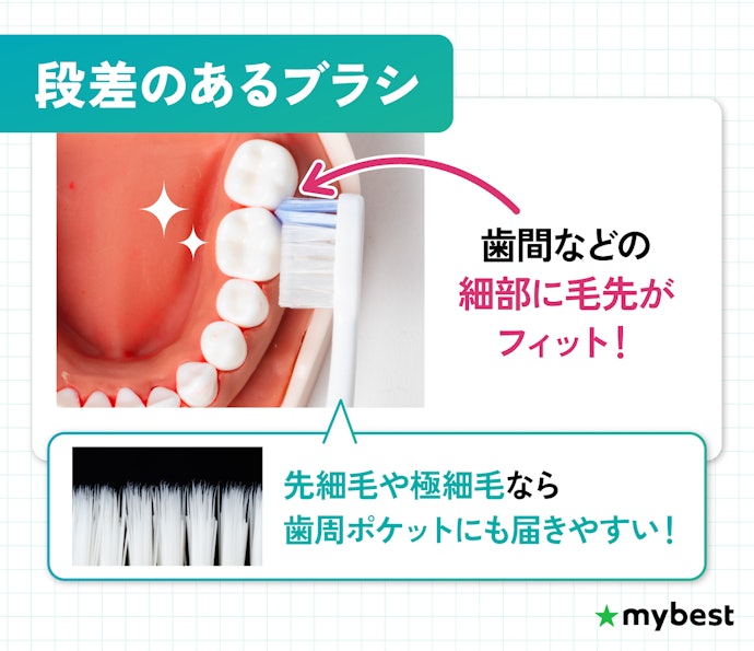 細部の歯垢には、段差のあるブラシがおすすめ。歯周ポケットには先細毛も