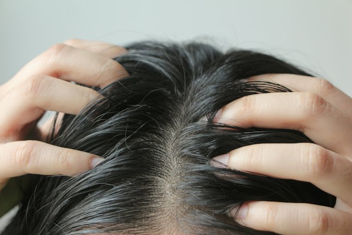 フケ・かゆみを防ぐなら、医薬部外品の有効成分をチェックしよう