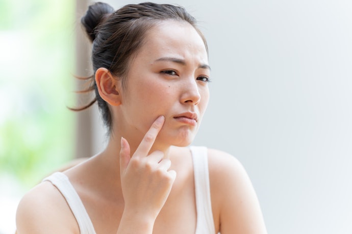 白ニキビにはイオウなどの角質軟化成分を