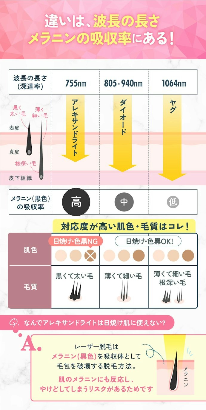 レーザーは主に3種類!それぞれ対応している「肌色・毛質」が異なる