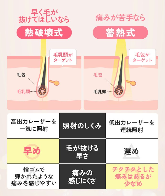 湘南美容クリニックの照射方法は熱破壊式