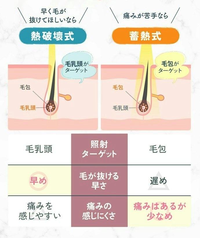 毛の抜けるスピード・痛みの感じ方で熱破壊・蓄熱式を選ぼう