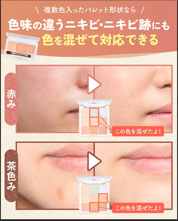 色味の違うニキビ・ニキビ跡がある人はクリームタイプを検討して