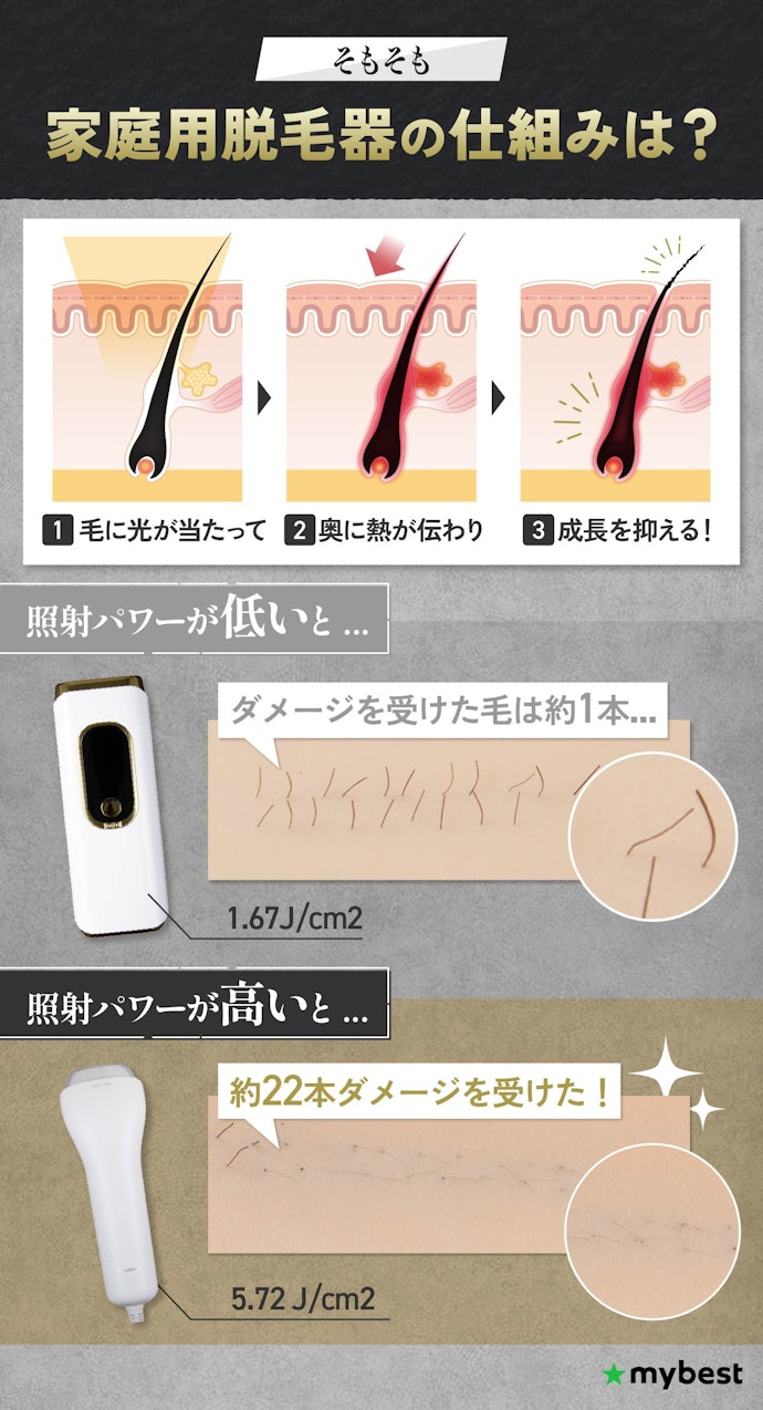 照射パワーの高いメンズ脱毛器がおすすめ