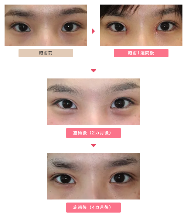 W法:大きな変化がほしい人向き