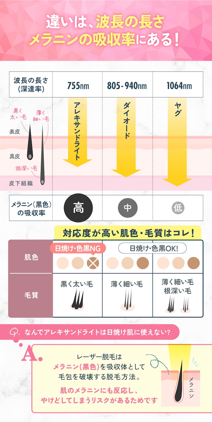 まずは、3種類のレーザーの特徴を確認!それぞれ対応している「肌色」「毛質」が異なる