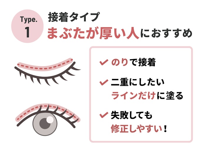 「二重を作りやすい」厚めのまぶたには接着タイプ