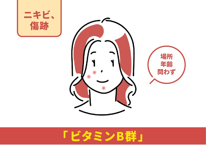 年齢を問わないニキビ跡や傷跡の色素沈着には「ビタミンB群」入りがおすすめ