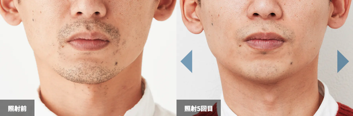 自己処理を楽にしたいなら「5〜6回」が目安