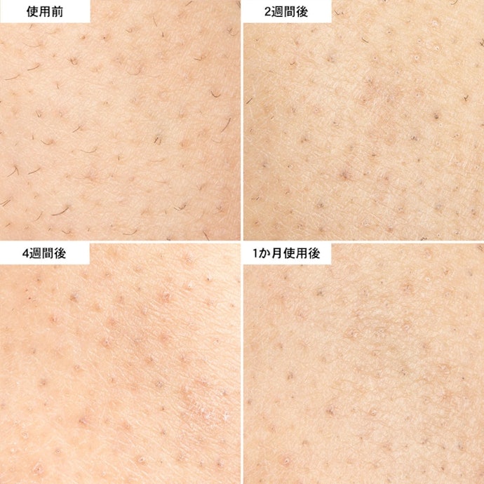 若干毛の残りはあるが、1か月で目立ちにくくなった