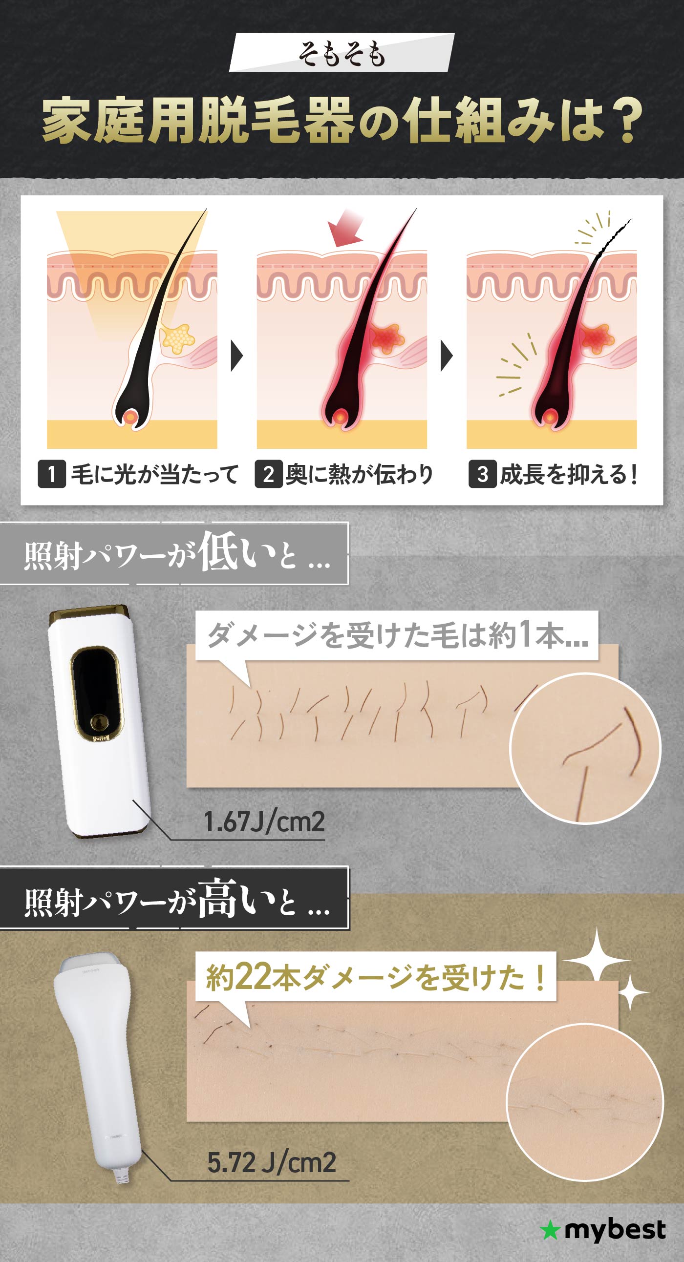 メンズ家庭用脱毛器のおすすめ人気ランキング【剛毛なヒゲ・VIOに！57