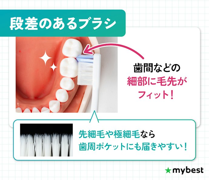 細部の歯垢には、段差のあるブラシがおすすめ。歯周ポケットには先細毛も