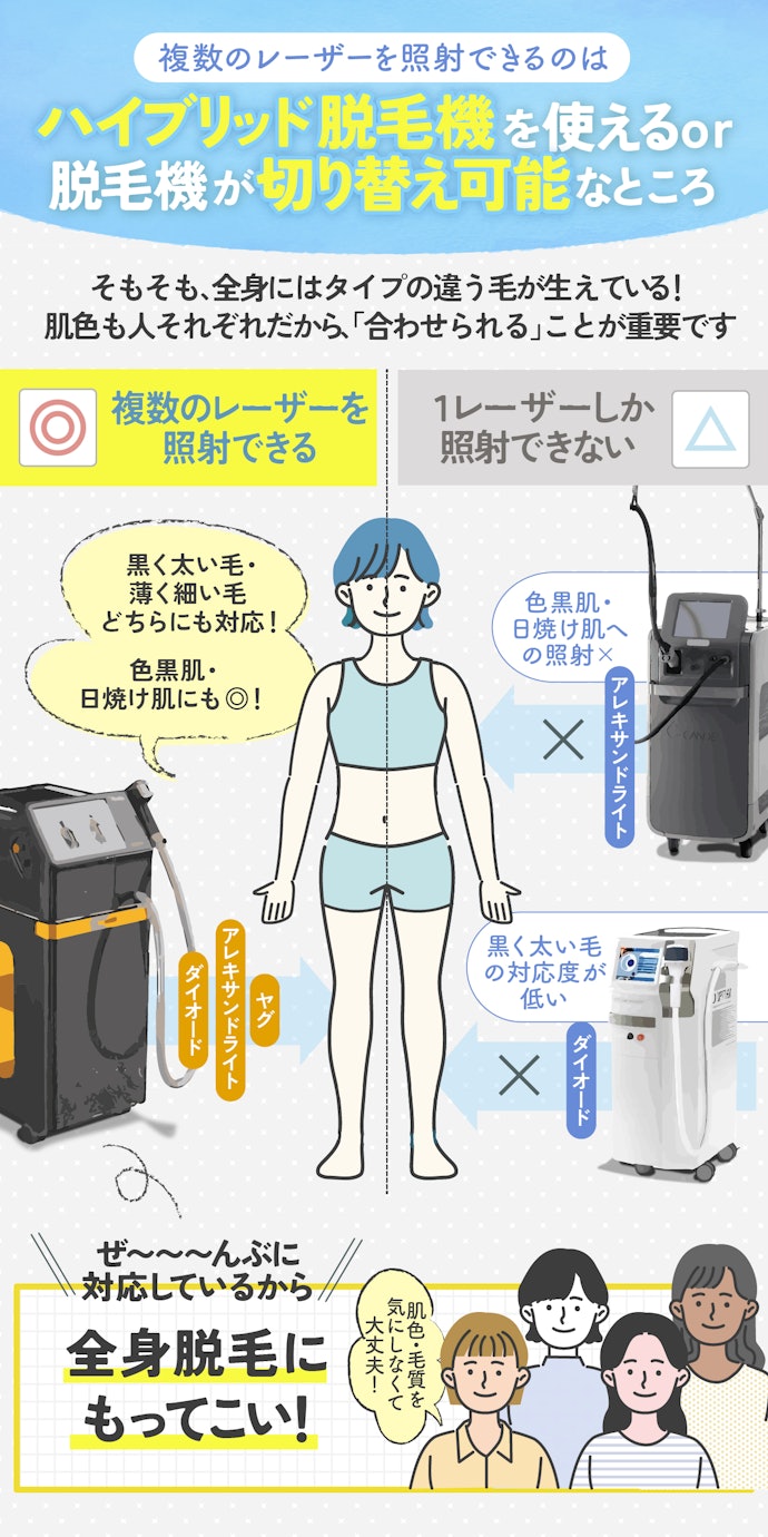 レーザーが1種類だけだと全身の幅広い毛質に対応できない。「複数のレーザー」を照射できるのがベター