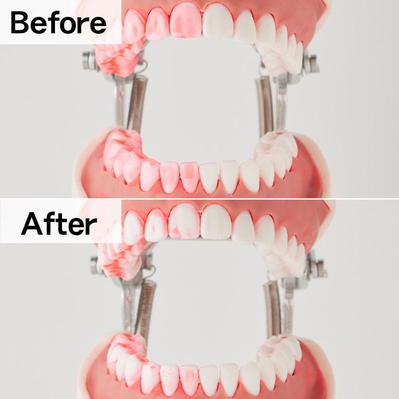 Waterpik（ウォーターピック）イオン WF-11Jをレビュー！クチコミ