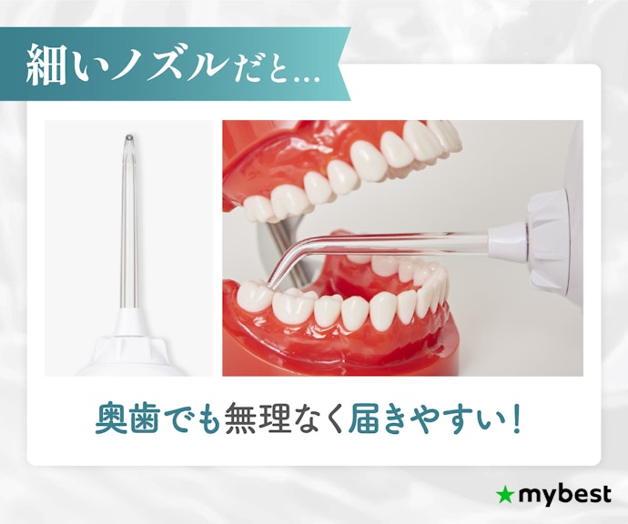 細ノズルなら細かい歯間の汚れも落としやすい