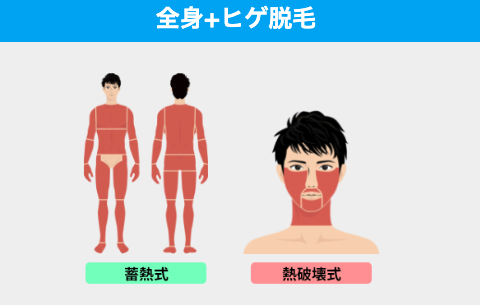 ②全身+ヒゲ脱毛