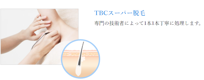 照射方式は不明。毛質によっては対応度が低い可能性がある