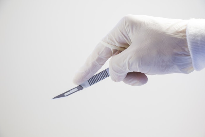 切開施術(剪除法):治療の効果が持続しやすく、保険適用される場合も