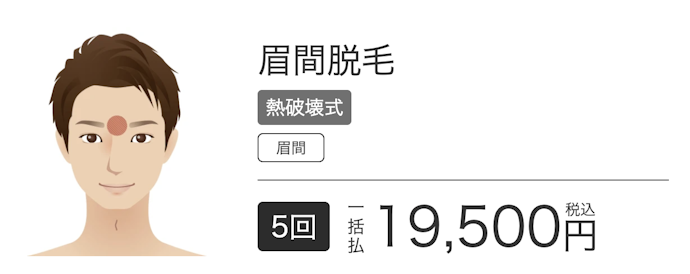 【オプションメニュー】眉間脱毛 熱破壊式5回