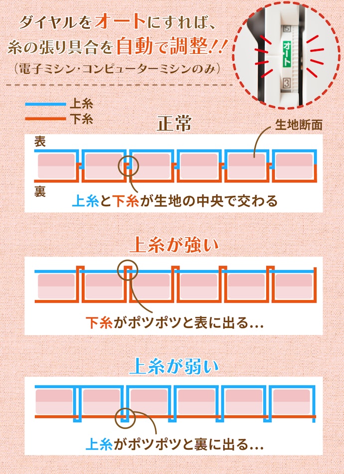 見栄えに直結!「自動糸調子機能」付きがおすすめ