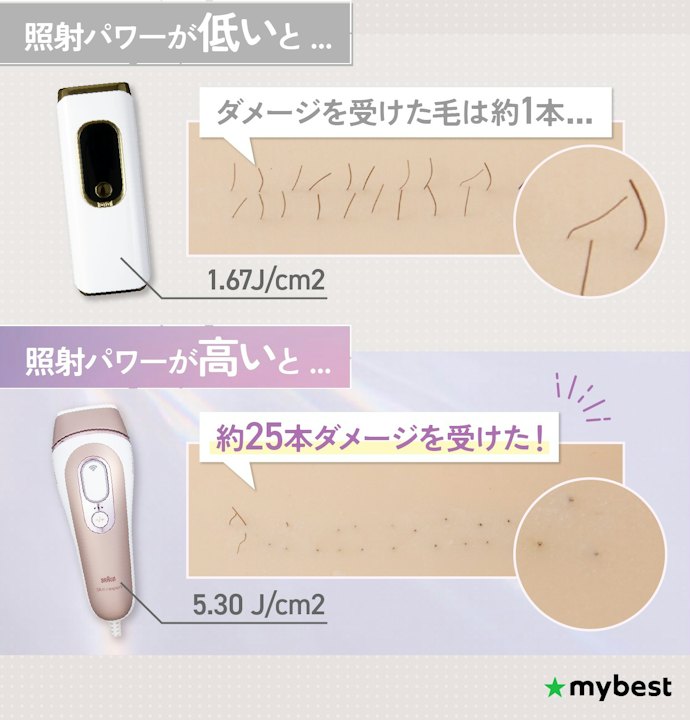 照射パワーの高い家庭用脱毛器がおすすめ