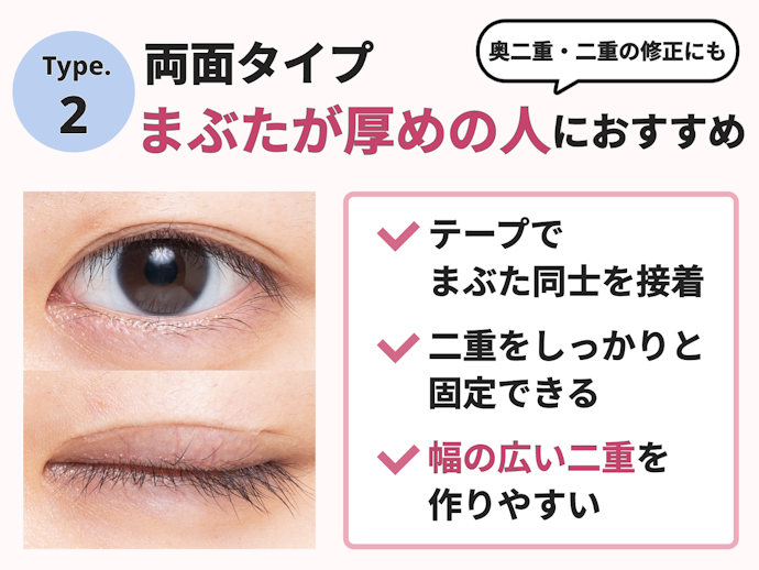 まぶたが厚い人は断然両面タイプ。もともと二重だが幅を広げたいという場合にもおすすめ