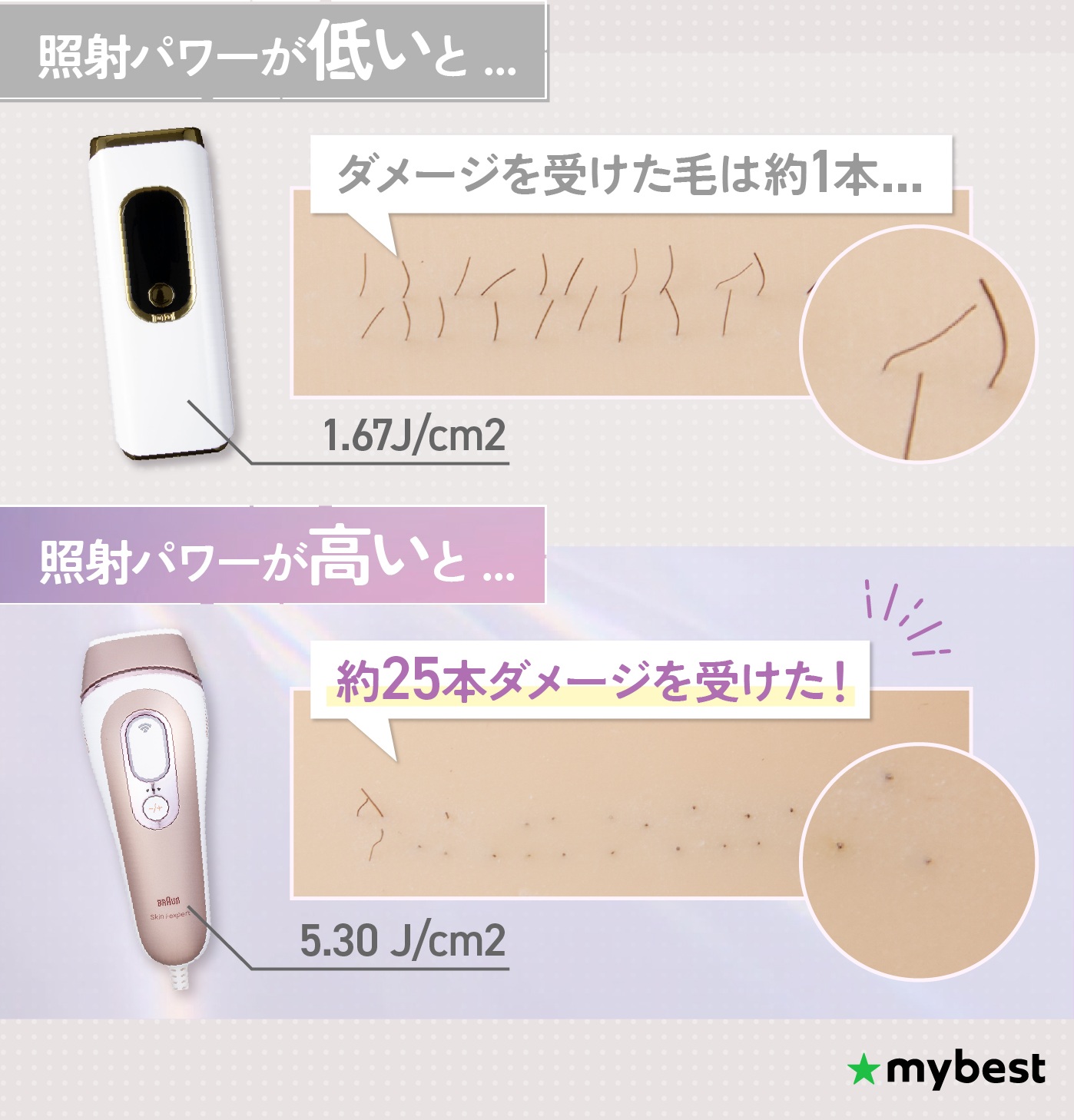 ReFa EPI （RE-BA） ReFa BEAUTECH EPI | PRODUCTS | ReFa | MTG Co., Ltd.