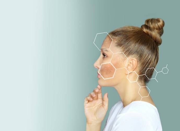 肝斑がある人は肝斑向けメニューの有無を確認しよう