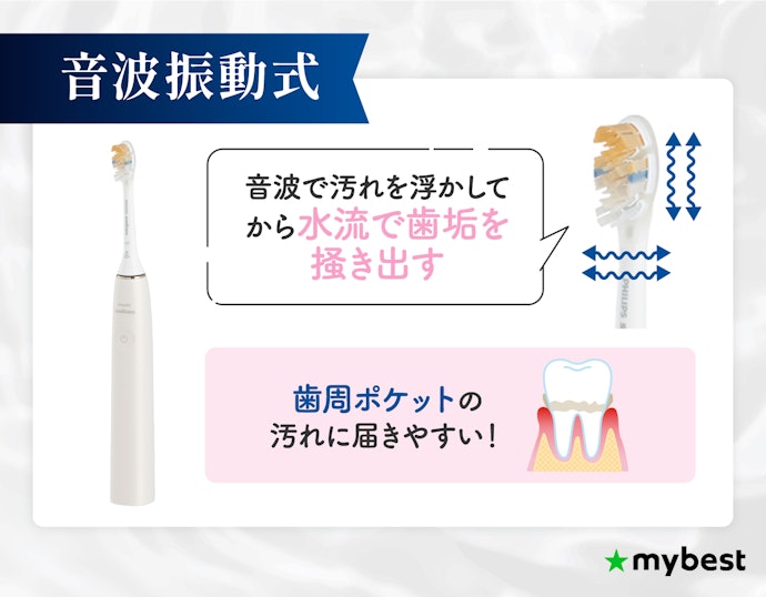 歯周ポケットの汚れが気になるなら、音波振動式がおすすめ
